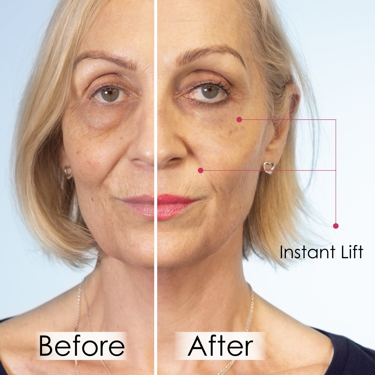skinChemists Wrinkle Killer Instant Lift with Hyaluronic Acid & Peptides