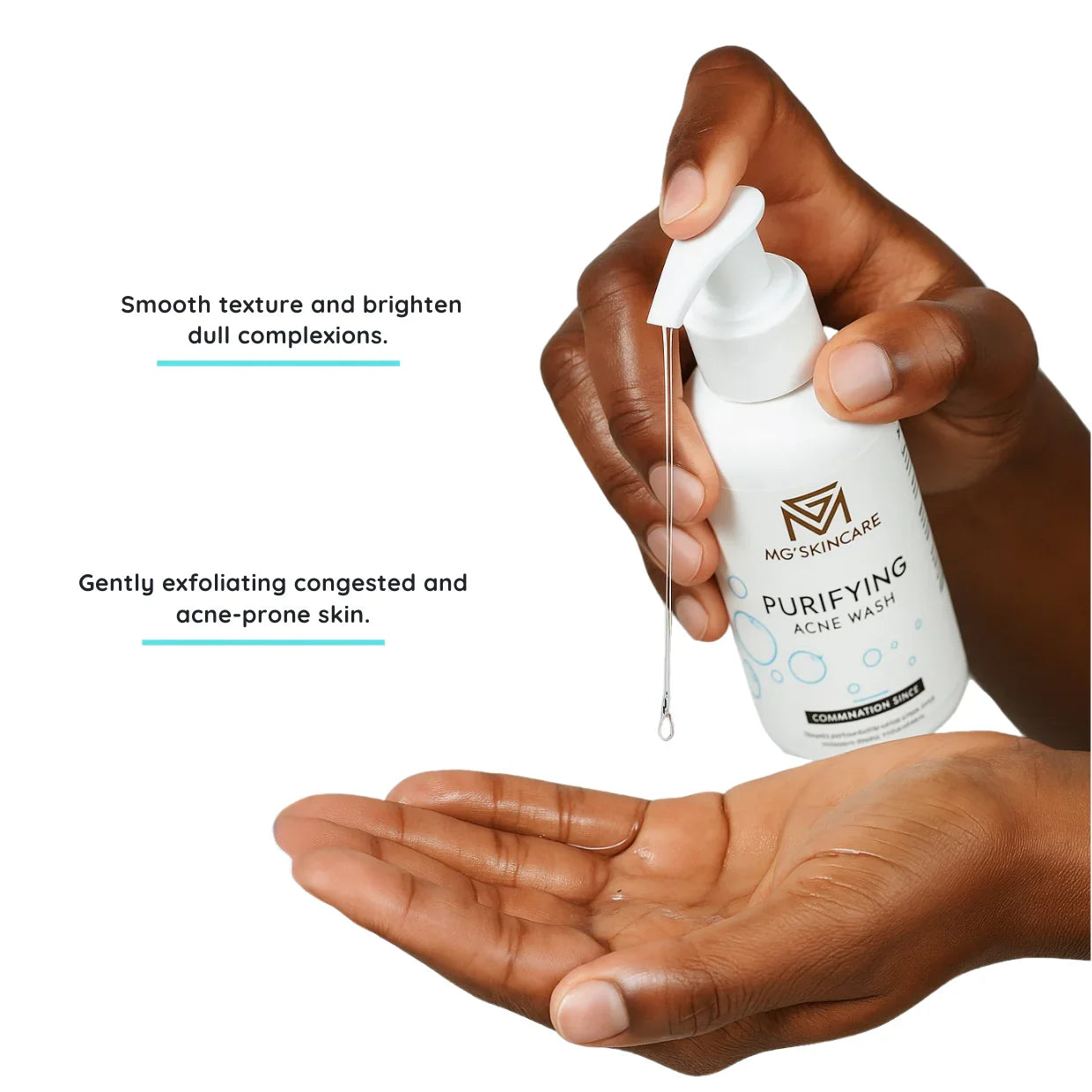 MG Skincare - PURIFYING  ACNE WASH