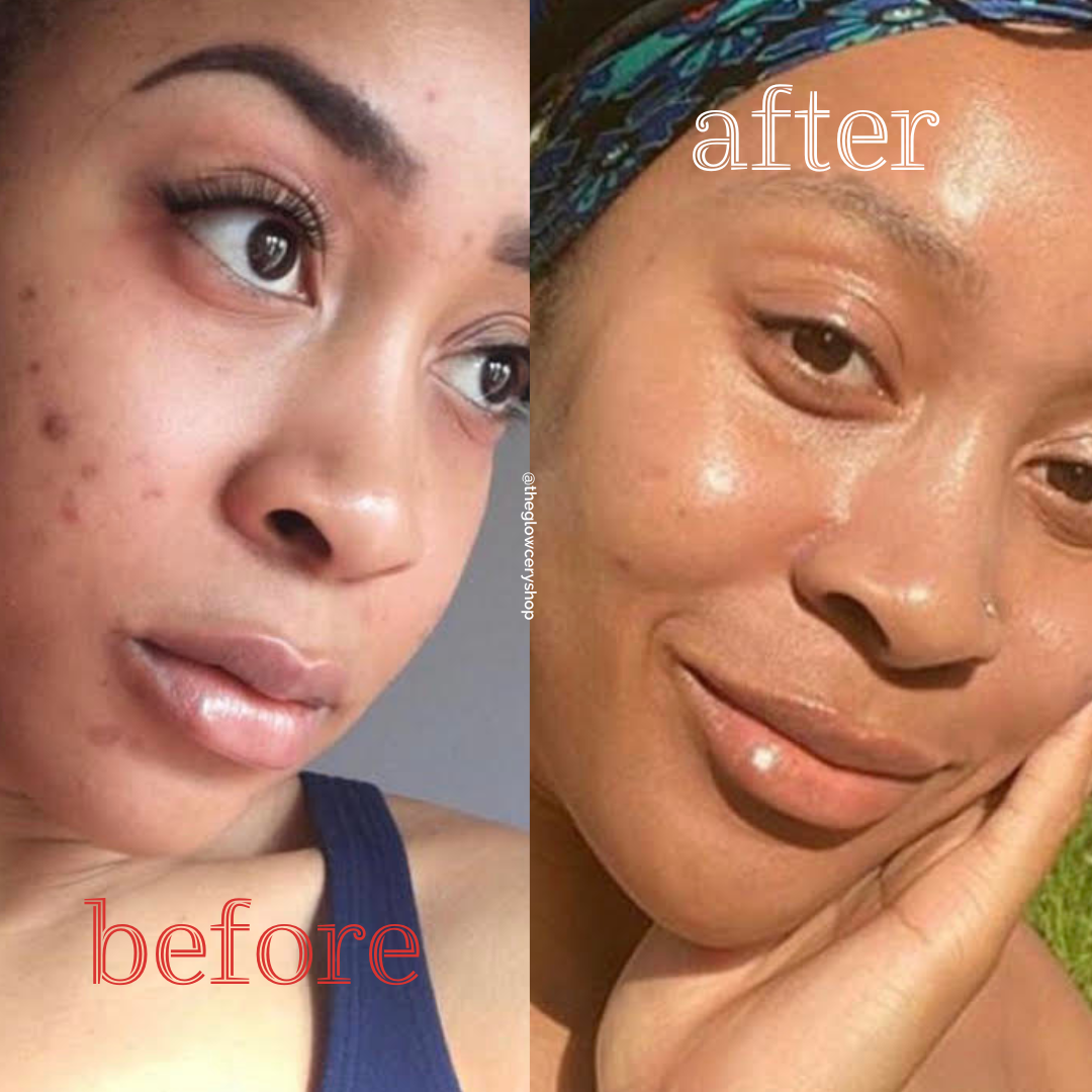 The Glowcery - Tomato Tonic Facial Oil