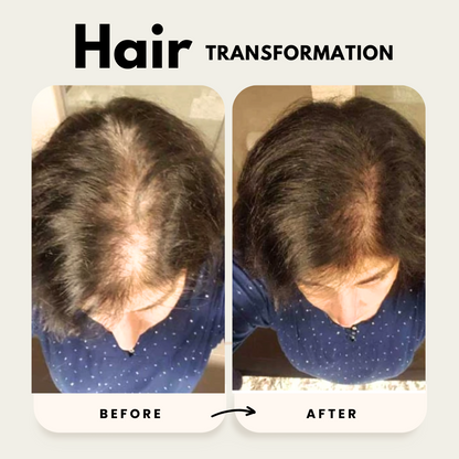 Lustrao Hair Growth Duo| Consistency Kit
