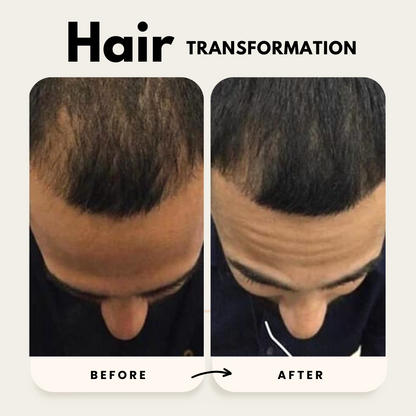 Lustrao Hair Growth Duo| Consistency Kit