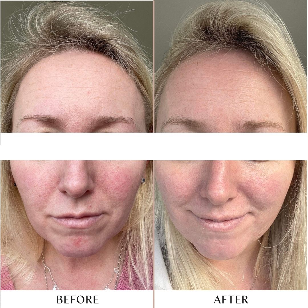 Pamoja Replenish Hydrating Serum