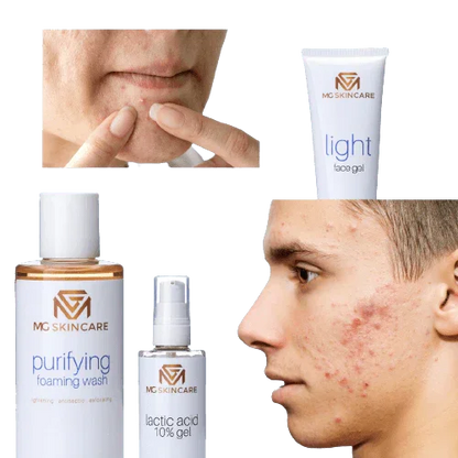 MG Skincare - PURIFYING FACE TONER