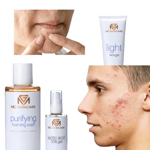MG Skincare - PURIFYING FACE TONER
