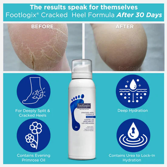 Footlogix Cracked Heel Formula (125ml)