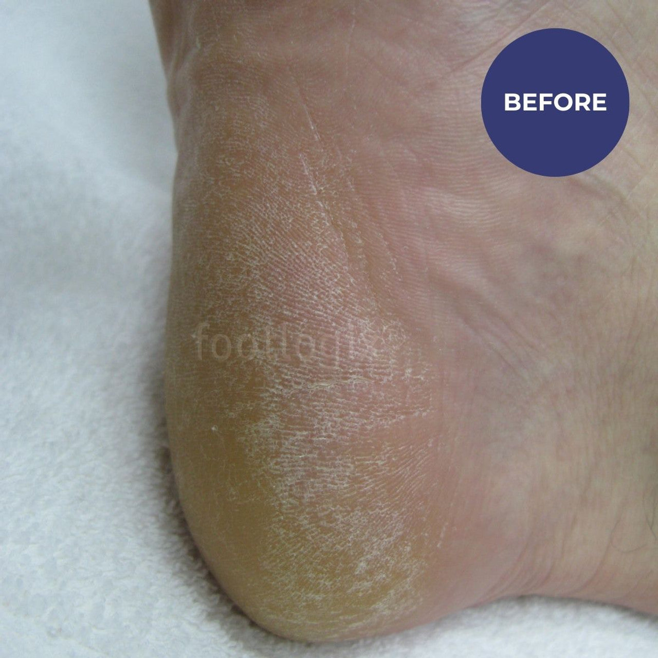 Footlogix Daily Maintenance Formula (125ml)