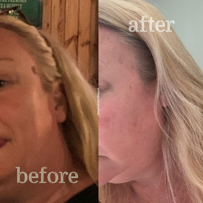 The Glowcery - Clean Greens Facial Oil