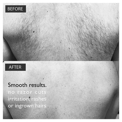 Baldape Parlour - Back & Body Hair Removal - The Silverback Kit