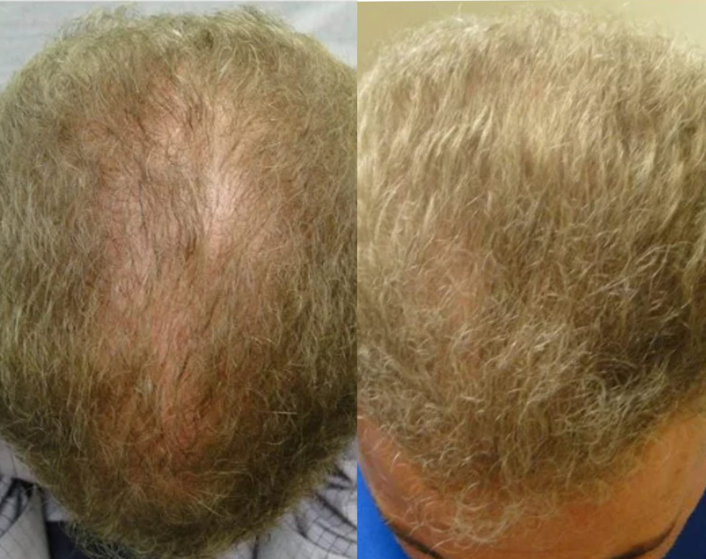 Lustrao Hair Regrowth Oil 60ml