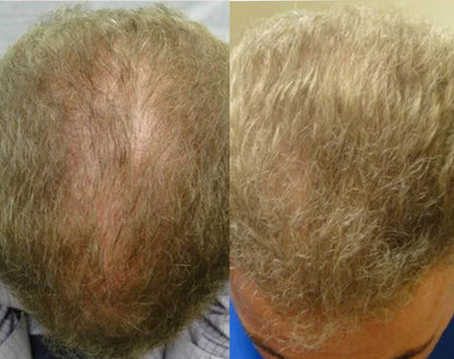 Lustrao Hair Regrowth Oil 60ml
