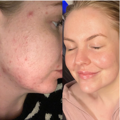 Bedew Skin - The Epidermal Vitamin Water