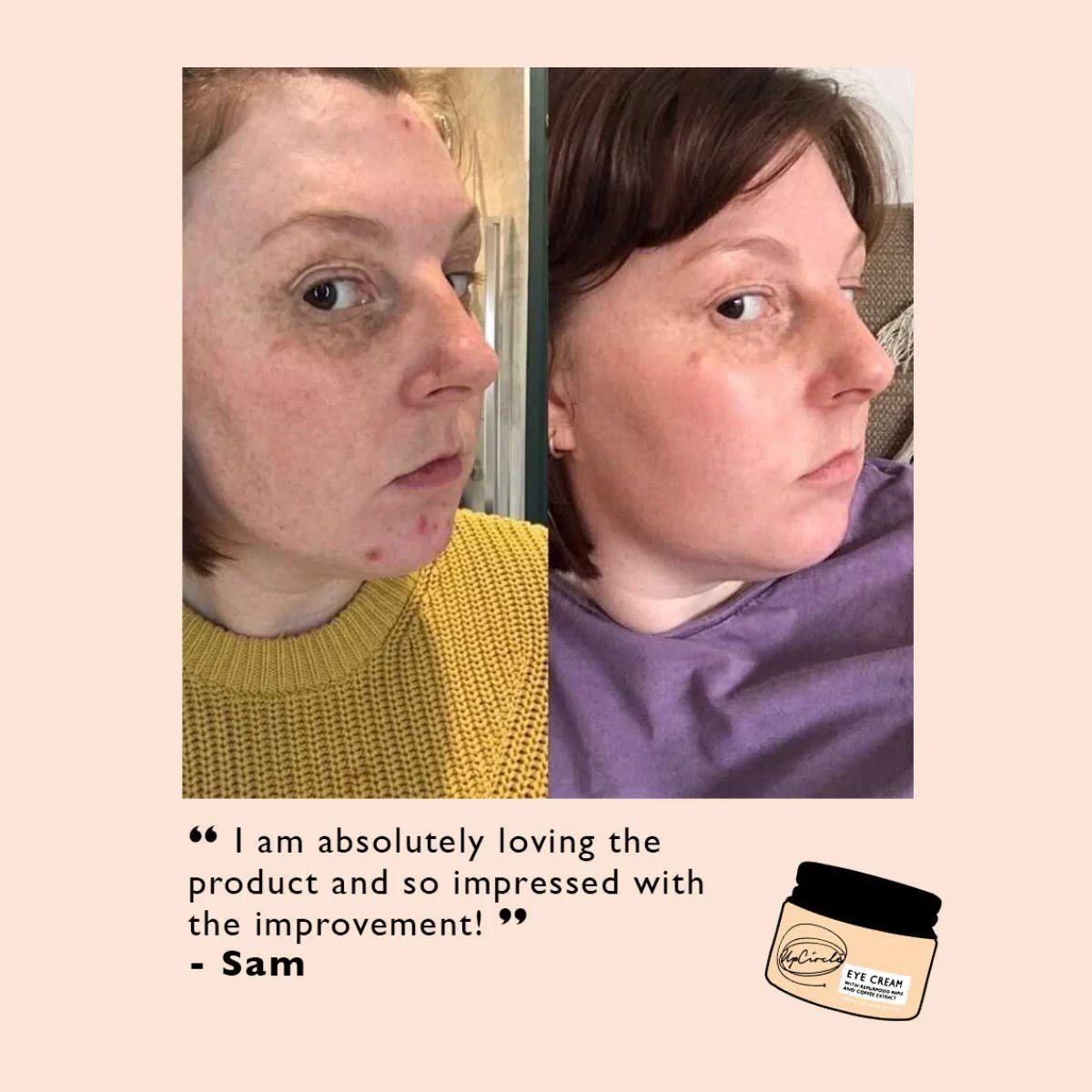 UpCircle Eye Cream with Hyaluronic Acid & Coffee 15ml