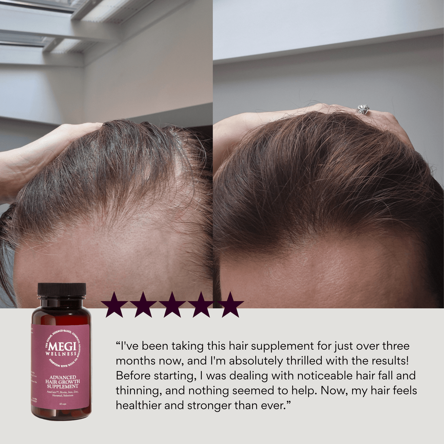 MEGIWellness Advanced Hair Growth Supplement