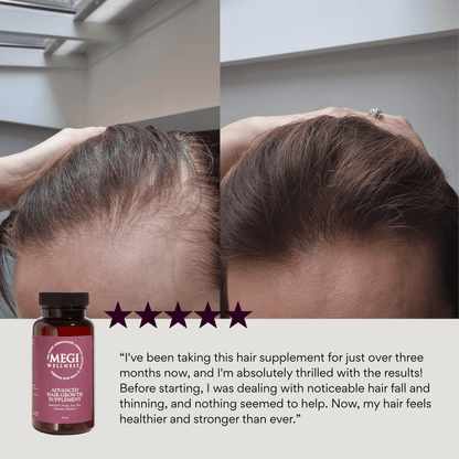 MEGIWellness Advanced Hair Growth Supplement