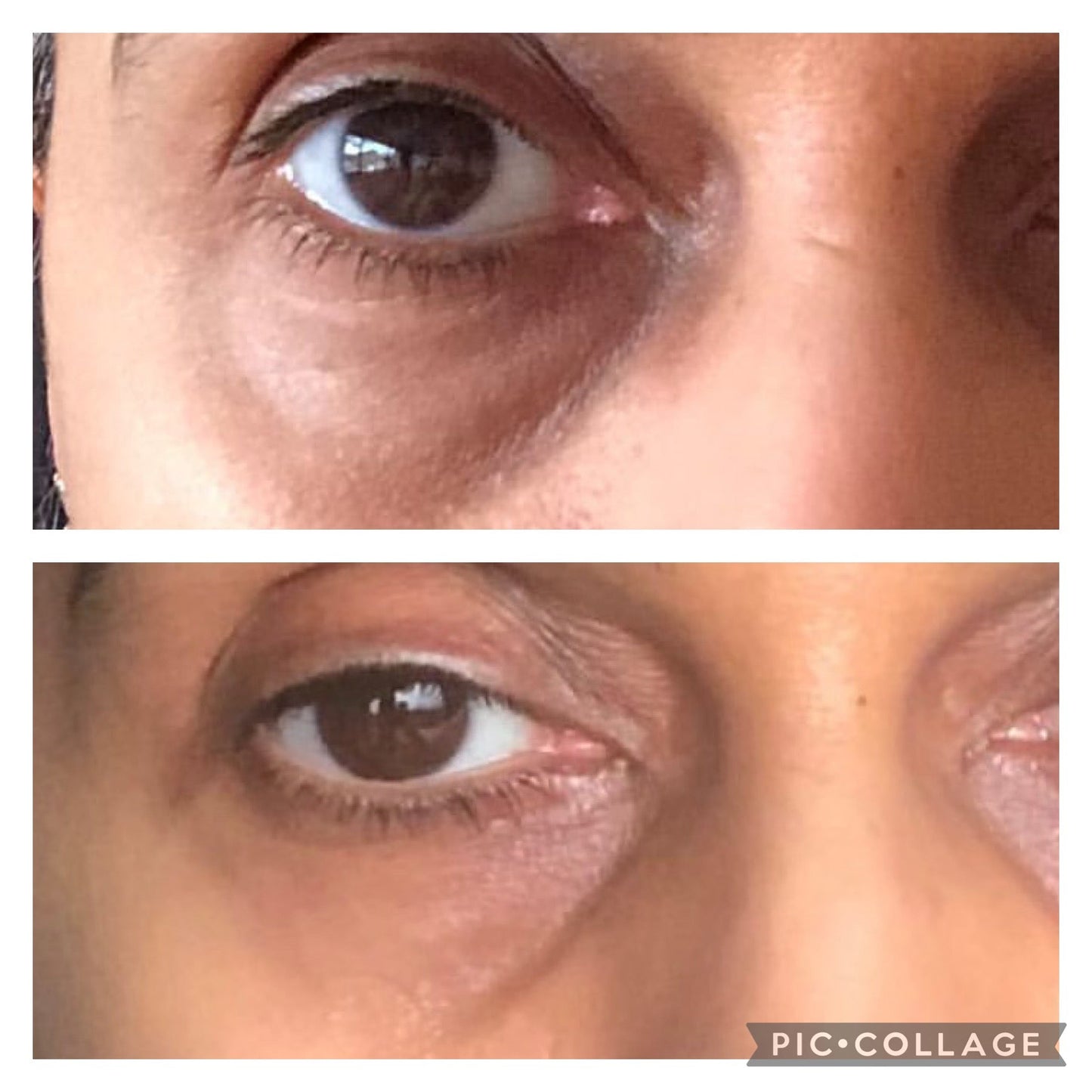Soloskin London Dark Circles Under Eye Oil