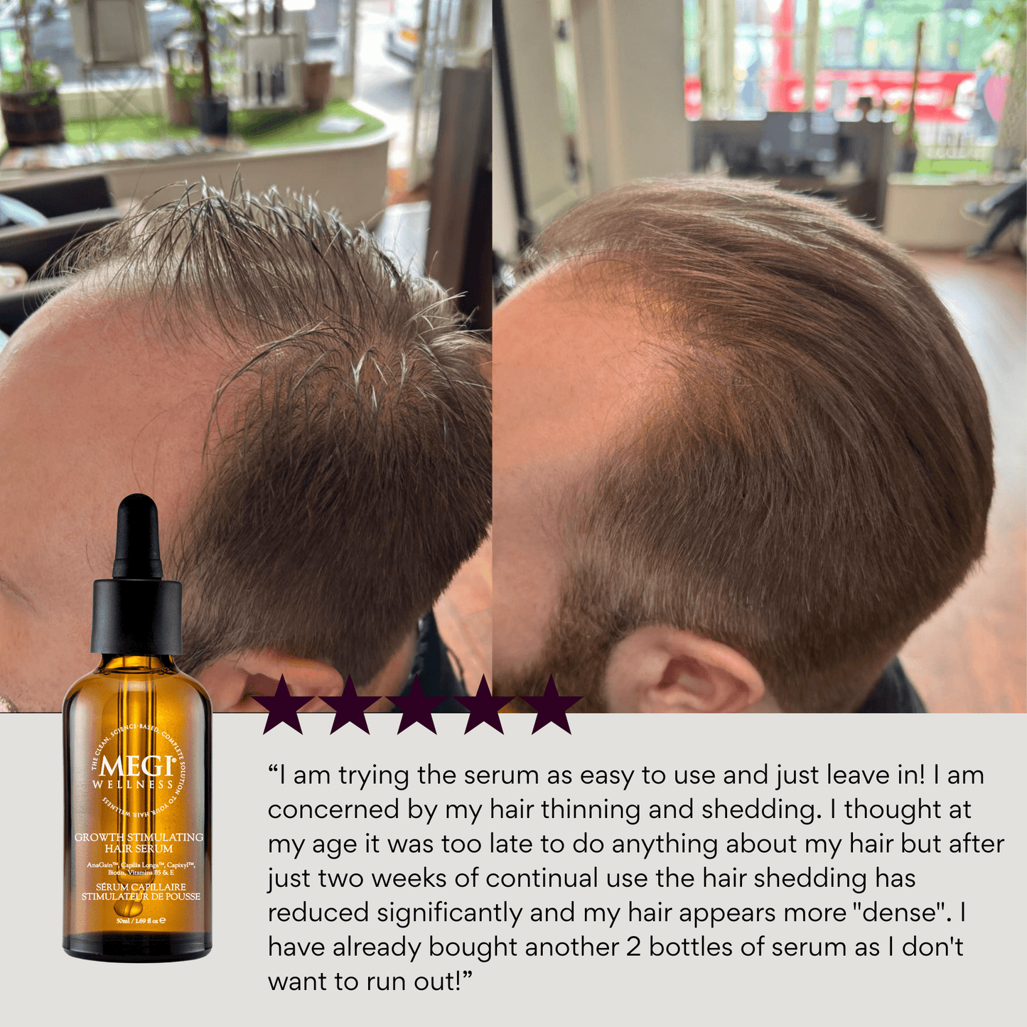 MEGIWellness Growth Stimulating Hair Serum