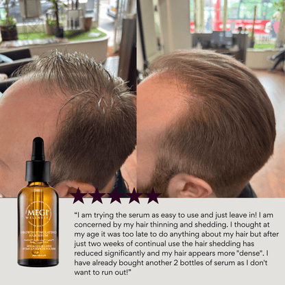MEGIWellness Growth Stimulating Hair Serum