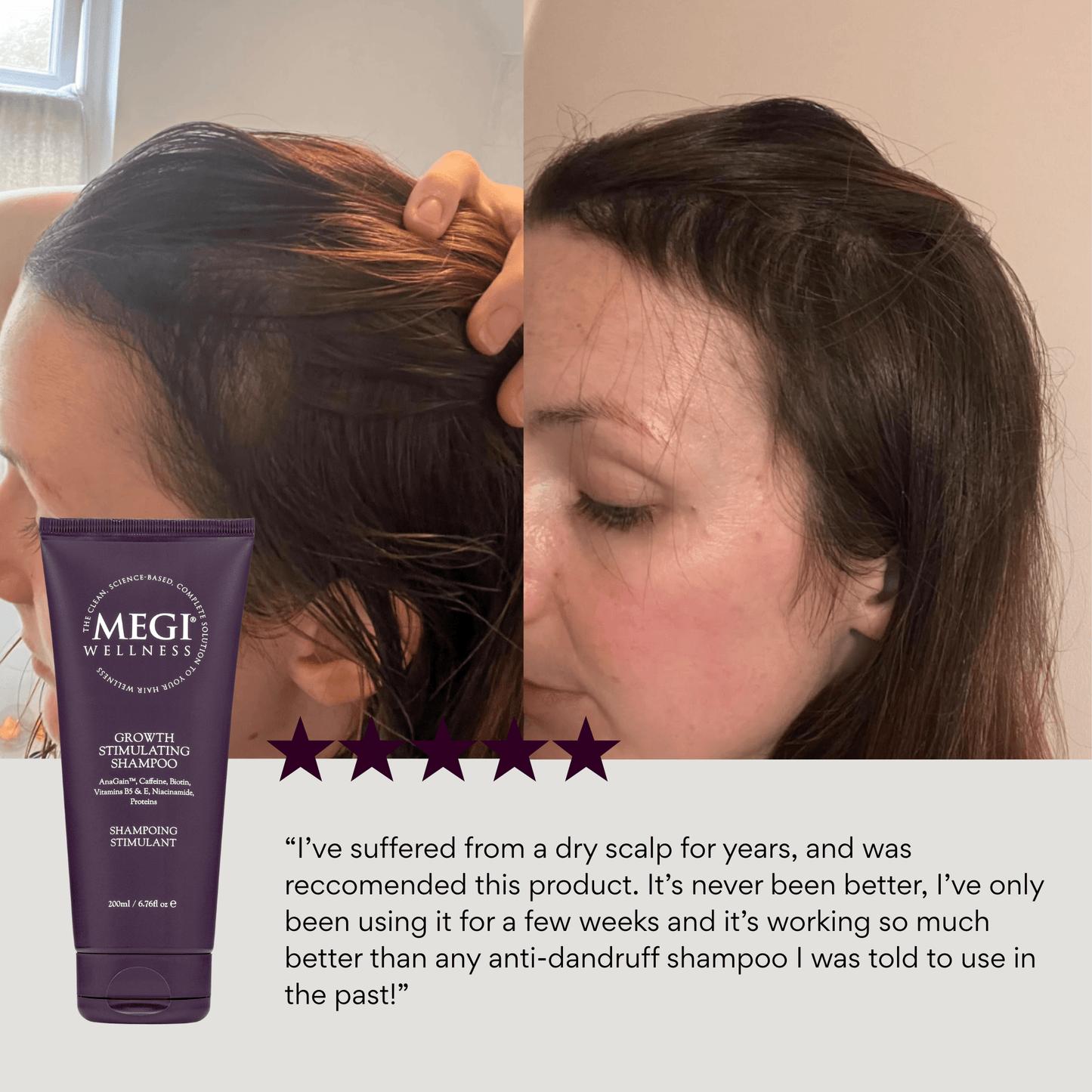 MEGIWellness Growth Stimulating Shampoo