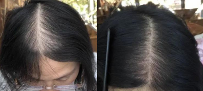 Lustrao Hair Regrowth Oil 60ml