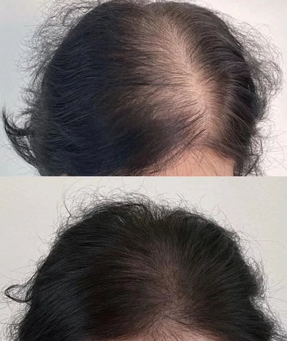 Lustrao Hair Regrowth Oil 60ml