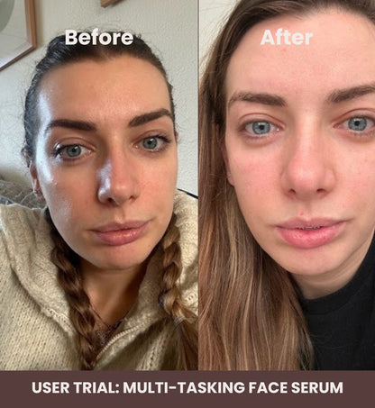 SKN TO SKN - MULTI-TASKING FACE SERUM 30ml