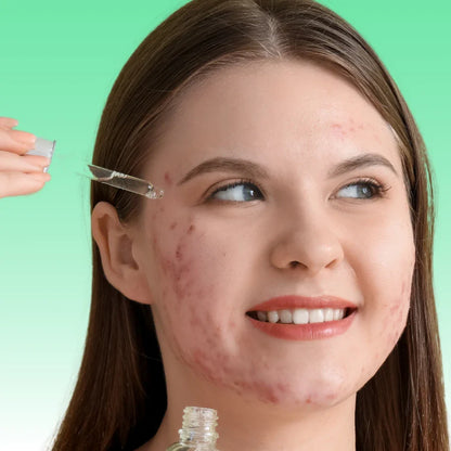 Beauty Cleanse Skincare - Blemish Blitz Superfood Face Oil